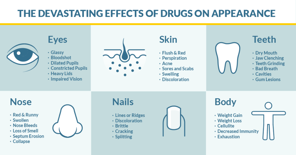 Subtle changes in a person's face and body that could indicate addiction - How can I help someone who is struggling with addiction?
