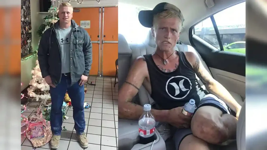 people before and after drugs