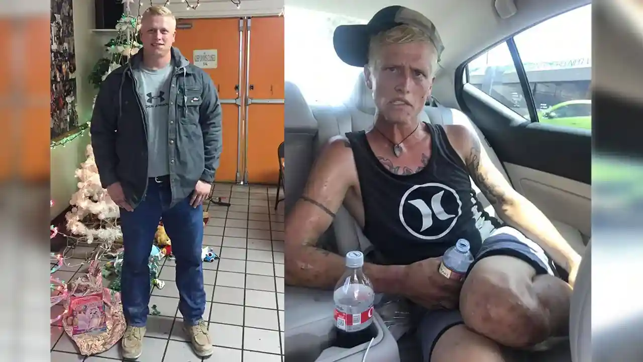 people before and after drugs